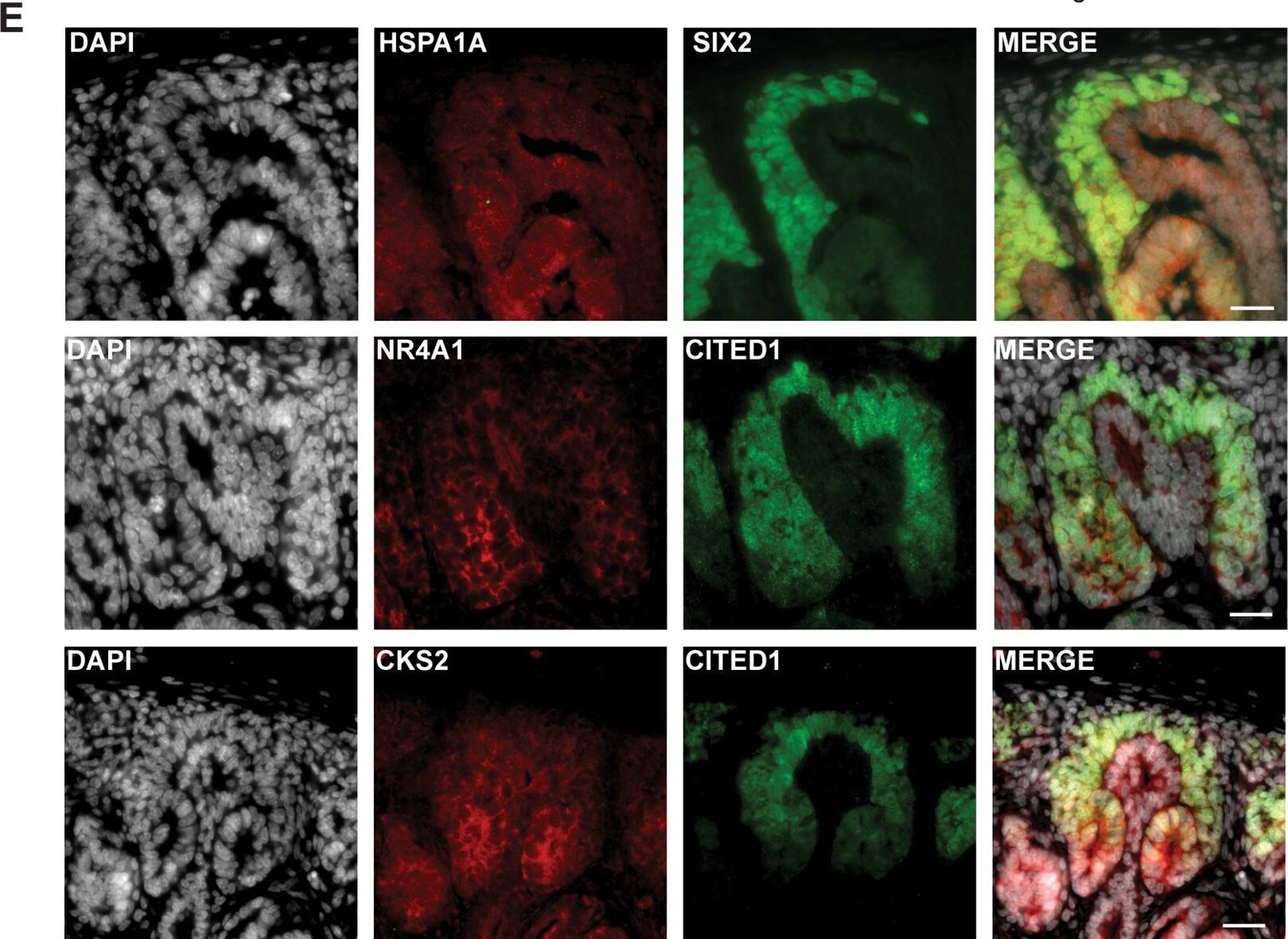 Immunocytochemistry/ Immunofluorescence: CITED1 Antibody (5H6) [H00004435-M03] - The nephrogenic niche exhibited a complex spatial organization.(A) Pseudotime analysis of the nephrogenic niche (NPC) & the PTA. Two-dimensional DDRTree [18] embedding & the learned graph (shown as a black line) were calculated with Monocle 2 [17]. Labels & colors indicate cell types. (B) Schematic sketch of the CM indicating the distance d from the UB to the edge of the CM (solid arrow) & the relative distance s along the UB (dashed arrow), in which 0 & 1 represent the top & bottom of the CM, respectively. (C) Representative image of SIX2 & CITED1 immunostaining in a w15 human fetal kidney. Dashed lines in the insets indicate the outline of the nuclei, based on DAPI signal. Arrows in the inset point to cells in which CITED1 is concentrated in the nucleus. Scale bar = 50 μm. (D) Quantification of SIX2 & CITED1 immunostaining with respect to the distance d from UB or distance s along the UB; see panel A. Error bars indicate the SEM calculated over all evaluated profiles (n = 24). (E) Representative image of HSPA1A, NR4A1, & CKS2 immunostaining in a w15 human fetal kidney. Scale bar = 20 μm. (F) Representative image of UNCX & CITED1 immunostaining. Arrowheads indicate the presence of immunostaining signal. Scale bar = 100 μm. The numerical data underlying this figure can be found in S1 Data. CM, cap mesenchyme; NPC, nephron progenitor cell; PTA, pretubular aggregate; SEM, standard error of the mean; UB, ureteric bud; w15, week 15. Image collected & cropped by CiteAb from the following publication (//pubmed.ncbi.nlm.nih.gov/30789893), licensed under a CC-BY license. Not internally tested by Novus Biologicals.