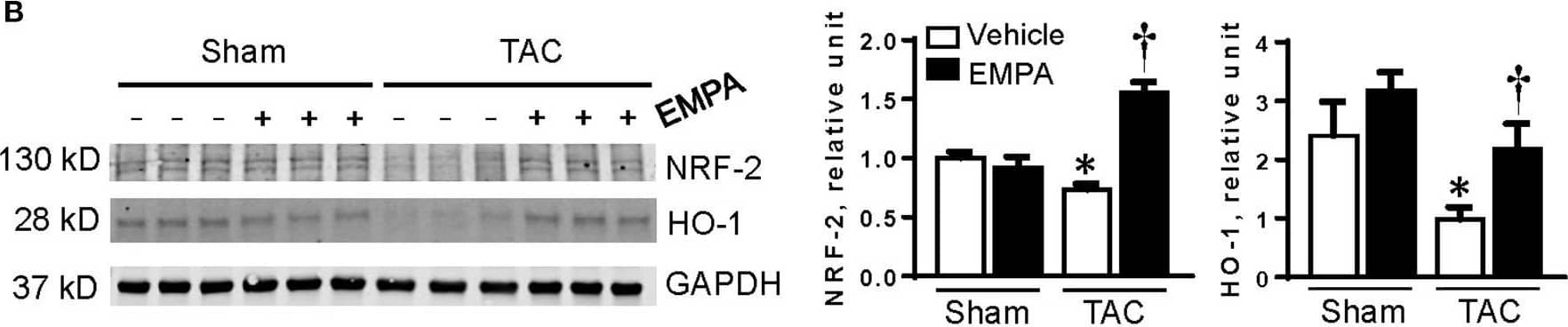 Western Blot: Nrf2 Antibody (2G7) [H00004780-M02] - EMPA treatment attenuated cardiomyocyte overproduction of reactive oxygen species (ROS) induced by TAC. (A) Left, Mitosox staining of cardiomyocytes in sham, sham + EMPA, TAC & TAC + EMPA groups & Right, quantitative results. (B) Representative blots of NRF-2 & HO-1, & quantitative results. (C) The relative mRNA levels of genes related to endogenous antioxidants. Results are expressed as mean ± SEM, n = 5–7, *p < 0.05 vs. corresponding sham group, †p < 0.05 vs. corresponding TAC vehicle group. One-way ANOVA & Tukey post hoc test. EMPA, empagliflozin; SEM, standard error of the mean; TAC, transverse aortic constriction; NRF-2, the nuclear factor erythroid 2–related factor 2; HO-1, heme oxygenase-1; GCLM, glutamate-cysteine ligase modifier subunit; GAPDH, glyceraldehyde 3-phosphate dehydrogenase. Image collected & cropped by CiteAb from the following publication (//pubmed.ncbi.nlm.nih.gov/35647080), licensed under a CC-BY license. Not internally tested by Novus Biologicals.