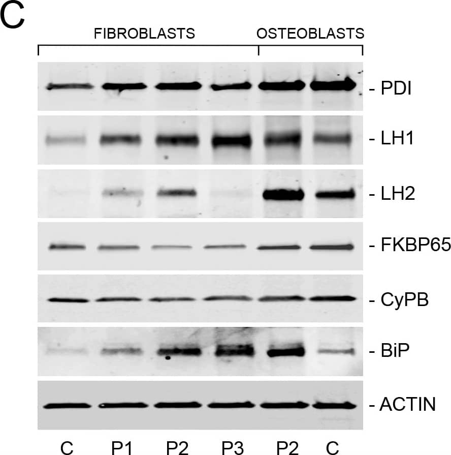 Western Blot: Protein Disulfide Isomerase/P4HB Antibody [H00005034-B01P] - Absence of TRIC-B alters expression of collagen-interacting proteins.(A) Quantitative RT-PCR of fibroblast transcripts encoding collagen, modifying enzymes & chaperones. Proband cells (P1, P2, & P3) demonstrate decreased expression of COL1A1 & FKBP10 (FKBP65), & increased expression of PLOD1 (LH1) & HSPA5 (BiP/GRP78) versus control fibroblasts (C). (B) Decreased expression of PLOD2 (LH2), FKBP10 (FKBP65) & PPIB (CyPB) in P2 osteoblasts versus control osteoblasts (C). (C) Immunoblots for quantitation of steady-state protein levels of collagen modifying enzymes & chaperones in proband & control cells. Proband fibroblasts show increases in PDI, LH1, LH2 & BiP protein levels. CyPB & FKBP65, both collagen-interacting isomerases, are consistently decreased in proband fibroblasts & osteoblasts. *, p < 0.05; **, p < 0.01; ***, p < 0.001. Image collected & cropped by CiteAb from the following publication (//dx.plos.org/10.1371/journal.pgen.1006156), licensed under a CC0-1.0 license. Not internally tested by Novus Biologicals.