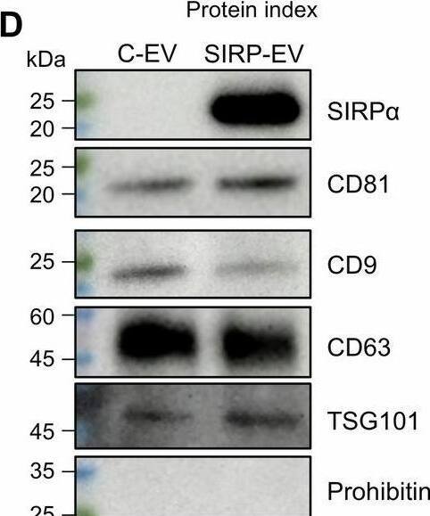 Comprehensive analysis of MSC-derived SIRP-EV.A–C Protein profile comparisons and reproducibility between C-EVs and SIRP-EVs. A Scatter plot consistency and R2 values for protein identification across replicates; Venn diagram overlaps of EV type-specific proteins. B Correlation coefficient analysis of protein profile similarities between replicates. C Quantification of SIRP alpha  overexpression in SIRP-EVs compared to C-EVs. D Protein expression of EVs to examine SIRP alpha , EV markers (CD81, CD9, CD63, and TSG101), and non-EV marker, prohibitin. E Representative cryo-TEM image of EVs. F Size distribution of EVs analyzed by DLS. G Zeta potential measurements of EVs analyzed using NTA, which denote the surface charge distribution (left, n = 3). MemGlow staining of EVs (right). H Network diagram displaying over-represented Gene Ontology Biological Processes (GOBPs) among the top 506 SIRP-EV proteins. Analysis shows the proportion of these proteins compared to the total, with significant GOBPs (P < 0.05) indicated by black and red lines for group and individual function significance, respectively. I Quantification of cell binding, following a 30-min co-incubation of Cy5.5-labeled C-EV and SIRP-EV with CD47 KO and CD47 WT cells (n = 3). Bar graph data are presented as mean +/- SD. Statistical significance was determined by two-tailed unpaired Student’s t test (G), two-way ANOVA with Sidak’s post hoc test by comparing the groups treated with the same concentration of EVs (I). ****P < 0.0001. Source data are provided as a Source Data file. Image collected and cropped by CiteAb from the following open publication (//pubmed.ncbi.nlm.nih.gov/39988725), licensed under a CC-BY license. Not internally tested by Novus Biologicals.
