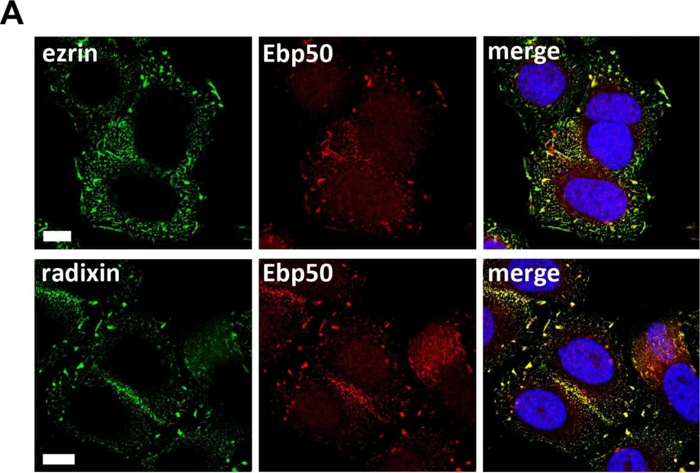 Immunocytochemistry/ Immunofluorescence: Radixin Antibody (1E12) [H00005962-M01] - Localization studies of ERM proteins, Ebp50 & ErbB2 in SKBR3 cells & protein proximity analysis(A) Confocal microscopy of ERM proteins & Ebp50. Untreated cells were fixed, permeabilized & stained by specific antibodies for endogenous levels of ezrin, radixin & Ebp50 (max. projection). In SKBR3 cells ezrin & radixin strongly colocalizes with Ebp50 at the plasma membrane. (B) Confocal microscopy (single plane section) & (C) 3D-SIM (max. projections) of ErbB2 & Ebp50 localization. In untreated control conditions, ErbB2 shows a strong colocalization with Ebp50 in lamellipodia-like structures at the plasma membrane. (D-F) Analysis of protein proximity by PLA experiments. SKBR3 cells were transfected either with non-targeting control siRNA or ezrin/radixin specific siRNA. Cells were fixed 72 h after transfection & PLA experiments were performed. The depletion of ezrin or radixin strongly reduces the interaction of ErbB2 with Ebp50 (D), Hsp90 (E) & ErbB3 (F). All results are shown as mean +/− SEM (*P < 0.05; ***P < 0.001). Scale bars: 10 μm (A, B), 8 μm (C). Image collected & cropped by CiteAb from the following publication (//pubmed.ncbi.nlm.nih.gov/27029001), licensed under a CC-BY license. Not internally tested by Novus Biologicals.