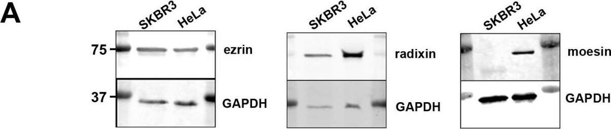 Western Blot: Radixin Antibody (1E12) [H00005962-M01] - ERM expression & localization in SKBR3 breast cancer cells(A) Western blot analysis of ERM levels in SKBR3, HeLa & PC3 cells. SKBR3 breast cancer cells do not express moesin. (B) Colocalization of ezrin/radixin & ErbB2 in SKBR3 cells. 3D-SIM of fixed cells, stained for endogenous ERM & ErbB2, shows a high degree of colocalization between the ezrin/radixin & ErbB2 at the plasma membrane (left panel: max. projection; middle: single plane section; right: single channels of insert). Scale bars: 10 μm. (C) Analysis of protein association in SKBR3 cells by proximity ligation assay (PLA). 2 h treatment with 3 μM GA leads to decreased association of ezrin/ErbB2 & radixin/ErbB2. Data is represented as mean +/− SEM (***P < 0.001). (D) Corresponding single plan section of a representative PLA experiment. Fluorescence & DIC pictures of control cells (upper panel) & cell treated for 2 h with geldanamycin (lower panel) are shown. Scale bars: 10 μm. Image collected & cropped by CiteAb from the following publication (//pubmed.ncbi.nlm.nih.gov/27029001), licensed under a CC-BY license. Not internally tested by Novus Biologicals.