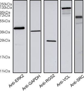 Western Blot: RGS2 Antibody (4C4) [H00005997-M01] - Specificity of antibodies. HEK293 cells lysates were analysed by Western blotting to test the specificity of antibodies. Image collected & cropped by CiteAb from the following publication (//rbej.biomedcentral.com/articles/10.1186/1477-7827-11-100), licensed under a CC-BY license. Not internally tested by Novus Biologicals.