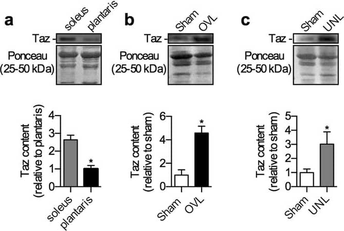 Western Blot: Tafazzin/TAZ Antibody (1B10) [H00006901-M12] - Taz protein expression is higher in the soleus compared with plantaris & is upregulated in response to both overload (OVL) & unload (UNL) stimuli. (a) Taz protein expression (~27 kDa) in the sham plantaris & soleus muscles. (b) Taz protein in the OVL plantaris compared with sham. (c) Taz protein in the UNL soleus compared with sham. *p ≤ 0.05 using a Student’s t-test (a, two-tailed) or paired t-test (b & c, two-tailed), n = 6 per group.  Please refer to Fig. S4 for full length Western blots. Image collected & cropped by CiteAb from the following publication (//pubmed.ncbi.nlm.nih.gov/28515468), licensed under a CC-BY license. Not internally tested by Novus Biologicals.