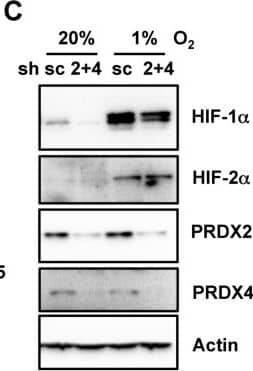 Western Blot: Peroxiredoxin 2 Antibody (4E10-2D2) [H00007001-M01] - Expression of PRDX2 or PRDX4 does not affect HIF-1 alpha  or HIF-2 alpha  protein levelsA. & B. HeLa cells were transfected with EV or vector encoding PRDX2-V5 (A, P2) or PRDX4-V5 (B, P4), & exposed to 20% or 1% O2 for 24 h. WCL was subject to immunoblot assays with antibody against HIF-1 alpha , HIF-2 alpha , V5, or acin. C. HeLa-shSC (sc) & HeLa-shPRDX(2+4) (2+4) cells were exposed to 20% or 1% O2 for 24 h in the presence of doxycycline. WCL was subject to immunoblot assays with antibodies against HIF-1 alpha , HIF-2 alpha , PRDX2, PRDX4, & actin. Image collected & cropped by CiteAb from the following publication (//www.oncotarget.com/lookup/doi/10.18632/oncotarget.7142), licensed under a CC-BY license. Not internally tested by Novus Biologicals.