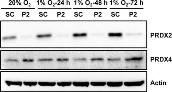 Western Blot: Peroxiredoxin 2 Antibody (4E10-2D2) [H00007001-M01] - PRDX2 knockdown increases PRDX4 protein levels in HeLa cellsHeLa subclones were exposed to 20% or 1% O2 for indicated time. Each WCL was subject to immunoblot assays with the indicated antibodies. SC, scrambled control shRNA. P2, PRDX2 shRNA. Image collected & cropped by CiteAb from the following publication (//www.oncotarget.com/lookup/doi/10.18632/oncotarget.7142), licensed under a CC-BY license. Not internally tested by Novus Biologicals.