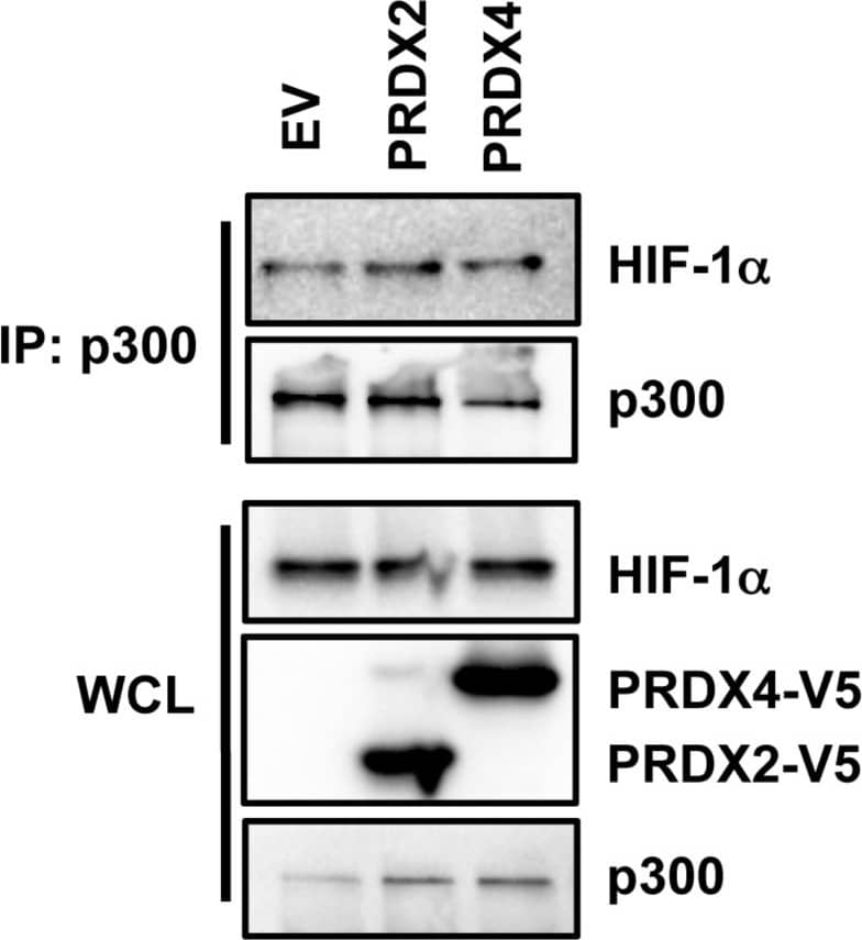 Western Blot: Peroxiredoxin 2 Antibody (4E10-2D2) [H00007001-M01] - Effect of PRDX2 & PRDX4 on HIF-1 alpha -p300 interactionHeLa cells were transfected with empty vector (EV) or vector encoding PRDX2-V5 or PRDX4-V5, & exposed to 1% O2 for 24 h. WCL was subject to IP with anti-p300 antibody, followed by immunoblot assays using antibodies against HIF-1 alpha , V5, & p300. Image collected & cropped by CiteAb from the following publication (//www.oncotarget.com/lookup/doi/10.18632/oncotarget.7142), licensed under a CC-BY license. Not internally tested by Novus Biologicals.