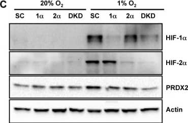 Western Blot: Peroxiredoxin 2 Antibody (4E10-2D2) [H00007001-M01] - PRDX2 expression is regulated by HIF-1 & HIF-2A. HeLa cells were exposed to 20% or 1% O2 for 24 h. RT-qPCR assays were performed using primers specific for the indicated mRNAs. Data are shown as mean ± SEM, n = 3. ***p < 0.001 versus 20% O2. B. HeLa cells were exposed to 20% or 1% O2 for the indicated time. WCLs were subject to immunoblot assays with antibodies against PRDX2, HIF-1 alpha , HIF-2 alpha , & actin. The PRDX2 & actin bands were quantified by densitometry & normalized to 0 h (20% O2). Normalized data are shown as mean ± SEM, n = 3. *p < 0.05, ***p < 0.001 versus 20% O2. C. HeLa-shSC (SC), HeLa-shHIF-1 alpha (1 alpha ), HeLa-shHIF-2 alpha (2 alpha ), & HeLa-sh1 alpha +2 alpha  (DKD) cells were exposed to 20% or 1% O2 for 72 h. WCLs were subject to immunoblot assays with antibodies against PRDX2, HIF-1 alpha , HIF-2 alpha , & actin. Image collected & cropped by CiteAb from the following publication (//www.oncotarget.com/lookup/doi/10.18632/oncotarget.7142), licensed under a CC-BY license. Not internally tested by Novus Biologicals.