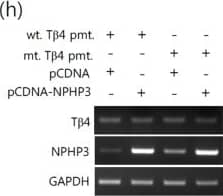 Western Blot: Thymosin beta 4 Antibody [H00007114-B01P] - No effect of T beta 4 on upstream-deleted mutant of NPHP3-promoter (pmt.). (a) Mutant (mt.) NPHP3-promoter plasmids were prepared from wildtype (wt.) promoter. (b–e) HeLa cells were transfected with pCMV-2B or pCMV-T beta 4 for 24 h. (b) HeLa cells were co-transfected with wildtype or mutant pEZX-PG02-NPHP3-promoter Gluc plasmid. & Gluc activity in cultured media was measured with luminometer using Gluc substrate. Bar graph indicates the mean of NPHP3-promoter activity. (c) Expression level of T beta 4 & NPHP3 transcripts were measured by RT-PCR. (d) The cells were fixed & stained with antibody against Ac-tubulin (red) & DAPI (blue). (e) The ciliated cells in pCMV-2B- (white) or pCMV-T beta 4-transfected group (grey) were counted. (f) Mutant (mt.) T beta 4-promoter plasmids were prepared from wildtype (wt.) promoter. (g,h) HeLa cells were transfected with pCDNA3.1 or pCDNA6-NPH3 for 24 h. (g) HeLa cells were co-transfected with wildtype or mutant pEZX-PG02-T beta 4-promoter Gluc plasmid. & Gluc activity in cultured media was measured with luminometer using Gluc substrate. Bar graph indicates the mean of T beta 4-promoter activity. (h) Expression level of T beta 4 & NPHP3 transcripts were measured by RT-PCR. Processing (such as changing brightness & contrast) is applied equally to controls across the entire image (c,d & h). Data in a bar graph represent the means ± SEM. **p < 0.01; significantly different from control group. &&p < 0.01; significantly different from wildtype promoter plasmid-transfected group. Image collected & cropped by CiteAb from the following publication (//pubmed.ncbi.nlm.nih.gov/31048733), licensed under a CC-BY license. Not internally tested by Novus Biologicals.