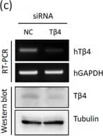 Western Blot: Thymosin beta 4 Antibody [H00007114-B01P] - No effect of T beta 4 on upstream-deleted mutant of NPHP3-promoter (pmt.). (a) Mutant (mt.) NPHP3-promoter plasmids were prepared from wildtype (wt.) promoter. (b–e) HeLa cells were transfected with pCMV-2B or pCMV-T beta 4 for 24 h. (b) HeLa cells were co-transfected with wildtype or mutant pEZX-PG02-NPHP3-promoter Gluc plasmid. & Gluc activity in cultured media was measured with luminometer using Gluc substrate. Bar graph indicates the mean of NPHP3-promoter activity. (c) Expression level of T beta 4 & NPHP3 transcripts were measured by RT-PCR. (d) The cells were fixed & stained with antibody against Ac-tubulin (red) & DAPI (blue). (e) The ciliated cells in pCMV-2B- (white) or pCMV-T beta 4-transfected group (grey) were counted. (f) Mutant (mt.) T beta 4-promoter plasmids were prepared from wildtype (wt.) promoter. (g,h) HeLa cells were transfected with pCDNA3.1 or pCDNA6-NPH3 for 24 h. (g) HeLa cells were co-transfected with wildtype or mutant pEZX-PG02-T beta 4-promoter Gluc plasmid. & Gluc activity in cultured media was measured with luminometer using Gluc substrate. Bar graph indicates the mean of T beta 4-promoter activity. (h) Expression level of T beta 4 & NPHP3 transcripts were measured by RT-PCR. Processing (such as changing brightness & contrast) is applied equally to controls across the entire image (c,d & h). Data in a bar graph represent the means ± SEM. **p  500 cells). (e,f) Cells were transfected with pEGFP-2B or pEGFP-T beta 4 plasmid for 24 h. (e) The expression of GFP & T beta 4-GFP were detected with GFP antibody. (f) The cells were fixed & stained with antibody against Ac-tubulin (red) & DAPI (blue). The ciliated cells in GFP (white) or T beta 4-GFP-positive cells (grey) were counted. Processing (such as changing brightness & contrast) is applied equally to controls across the entire image. Data in a bar graph represent the means ± SEM. **p < 0.01; significantly different from control cells. Image collected & cropped by CiteAb from the following publication (//pubmed.ncbi.nlm.nih.gov/31048733), licensed under a CC-BY license. Not internally tested by Novus Biologicals.