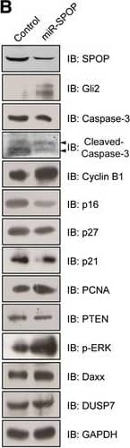 Western Blot: SPOP Antibody [H00008405-B01P] - SPOP promotes tumor cell apoptosis. (A) Overexpression of SPOP upregulates the expression of apoptotic proteins. MKN45 cells were transfected with Myc-SPOP & incubated for 48 h. Target proteins in cell lysates were detected by indicated antibodies using Western blotting. (B) Repression of SPOP inhibits cancer cell apoptosis. MKN45 cells were transfected with miR-SPOP-1430 & incubated for 48 h. Target proteins in cell lysates were probed with indicated antibodies using Western blotting. (C) Overexpressed SPOP promotes cleaved Caspase-3 expression. AGS cells were transfected with Myc-SPOP for 48 h & then fixed. Myc-SPOP was detected by incubating cells with mouse anti-Myc antibody & subsequently Alexa Fluor 488 goat anti-mouse antibody. Cleaved Caspase-3 was detected by incubating cells with rabbit anti-cleaved Caspase-3 & subsequently Alexa Fluor 594 donkey anti-rabbit antibody. Nucleus was identified by DAPI staining. (D) The representative photos of cleaved Caspase-3 expression in gastric cancer tissues & adjacent gastric tissues by using immunohistochemical staining (DAB staining, scale bar, 100 μm). Magnified local images reflecting detailed information were shown on the bottom. Image collected & cropped by CiteAb from the following publication (//pubmed.ncbi.nlm.nih.gov/25204354), licensed under a CC-BY license. Not internally tested by Novus Biologicals.