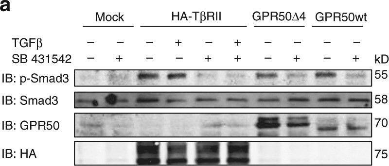 Western Blot: GPR50 Antibody [H00009248-B01P] - GPR50 phosphorylate & activate T beta RI independently of T beta RII. a SNU638 cells were transfected with the indicated plasmids, stimulated for 1 h with TGF beta  (2 ng/mL) & pretreated or not overnight with SB431542 at 10 µM. p-Smad3 & total Smad3 levels & expression of transfected plasmids were determined by western blot in cell lysates. b Co-immunoprecipitation of GRP50 & T beta RI in lysates of SNU638 cells expressing HA-T beta RI alone or together with GPR50 delta 4. Total lysates were used as expression control (c) SNU638 cells were transfected with the indicated plasmids, stimulated TGF beta  (2 ng/mL, 1 h). Total T beta RI was immunoprecipitated with anti-Flag antibody & immunoblotted for anti-T beta RIp-S165. Below, the same blot was immunoblotted with anti-Flag to show the amount of T beta RI precipitation in cell lysates. d Phospho-Smad3 & Smad2/3 levels were determined in lysates of SNU638 cells stimulated or not with TGF beta  (2 ng/mL, 1 h) & expressing the indicated proteins (as verified by western blot). The myc-MT2 melatonin receptor & the myc-MT2-GPR50Cter served as negative controls. Representative results are shown for all the panels. Similar results were obtained in at least two additional experiments. See also Supplementary Fig. 4 Image collected & cropped by CiteAb from the following publication (//www.nature.com/articles/s41467-018-03609-x), licensed under a CC-BY license. Not internally tested by Novus Biologicals.