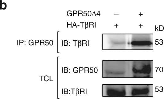 Western Blot: GPR50 Antibody [H00009248-B01P] - GPR50 phosphorylate & activate T beta RI independently of T beta RII. a SNU638 cells were transfected with the indicated plasmids, stimulated for 1 h with TGF beta  (2 ng/mL) & pretreated or not overnight with SB431542 at 10 µM. p-Smad3 & total Smad3 levels & expression of transfected plasmids were determined by western blot in cell lysates. b Co-immunoprecipitation of GRP50 & T beta RI in lysates of SNU638 cells expressing HA-T beta RI alone or together with GPR50 delta 4. Total lysates were used as expression control (c) SNU638 cells were transfected with the indicated plasmids, stimulated TGF beta  (2 ng/mL, 1 h). Total T beta RI was immunoprecipitated with anti-Flag antibody & immunoblotted for anti-T beta RIp-S165. Below, the same blot was immunoblotted with anti-Flag to show the amount of T beta RI precipitation in cell lysates. d Phospho-Smad3 & Smad2/3 levels were determined in lysates of SNU638 cells stimulated or not with TGF beta  (2 ng/mL, 1 h) & expressing the indicated proteins (as verified by western blot). The myc-MT2 melatonin receptor & the myc-MT2-GPR50Cter served as negative controls. Representative results are shown for all the panels. Similar results were obtained in at least two additional experiments. See also Supplementary Fig. 4 Image collected & cropped by CiteAb from the following publication (//www.nature.com/articles/s41467-018-03609-x), licensed under a CC-BY license. Not internally tested by Novus Biologicals.