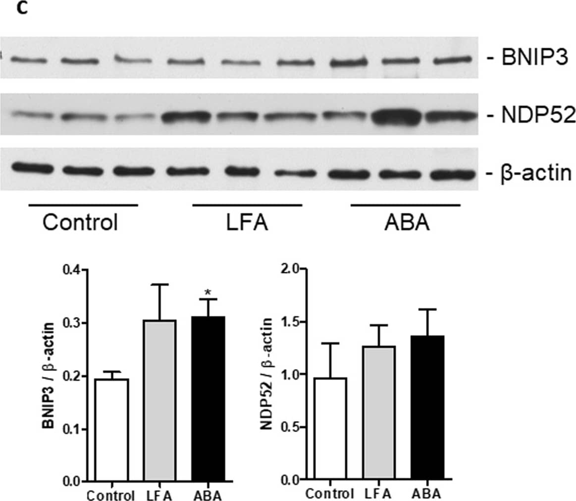 Western Blot NDP52 Antibody