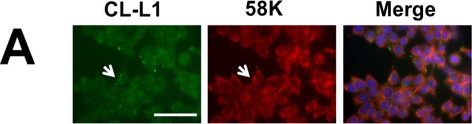 Immunocytochemistry/ Immunofluorescence: COLEC10 Antibody (4C1) [H00010584-M01] - Cellular & embryonic localisation of CL-L1.A. Immunostaining of ATDC5 cells with the golgi marker 58K & CL-L1. CL-L1 shows localisation with golgi apparatus (white arrow). B. Laminin & CL-L1 coimmunolocalisation. Laminin shows partial cellular immunolocalisiton with CL-L1 around the golgi area (arrows). Scale bar 50 μm C. Laminin & CL-K1 coimmunolocalisation. CL-K1 staining shows a very strong golgi localisation with partial cytoplasmatic laminin colocalisation. D. CL-L1 immunohistochemistry of a 18.5 days postfertilisation mouse embryo. CL-L1 is expressed in the liver (long arrow) & submucosal patal region (short arrows). E. Immunofluorescence showing co-localisation of CL-L1 & Laminin in E13.5 mouse embryos sections. CL-L1 is expressed in the basal membrane of the ephithelium in the palate shelf of the maxilla (arrows). In contrast Laminin expression is present all around the ephitelium membrane. A faint but clear CL-L1 expression is also observed in the cytoplasm of the epithelium & in the mesenchyme of the palate. PSM; rostral extremity of right palatal shelf of maxilla. Scale bar 100 μm. Image collected & cropped by CiteAb from the following publication (//pubmed.ncbi.nlm.nih.gov/28301481), licensed under a CC-BY license. Not internally tested by Novus Biologicals.