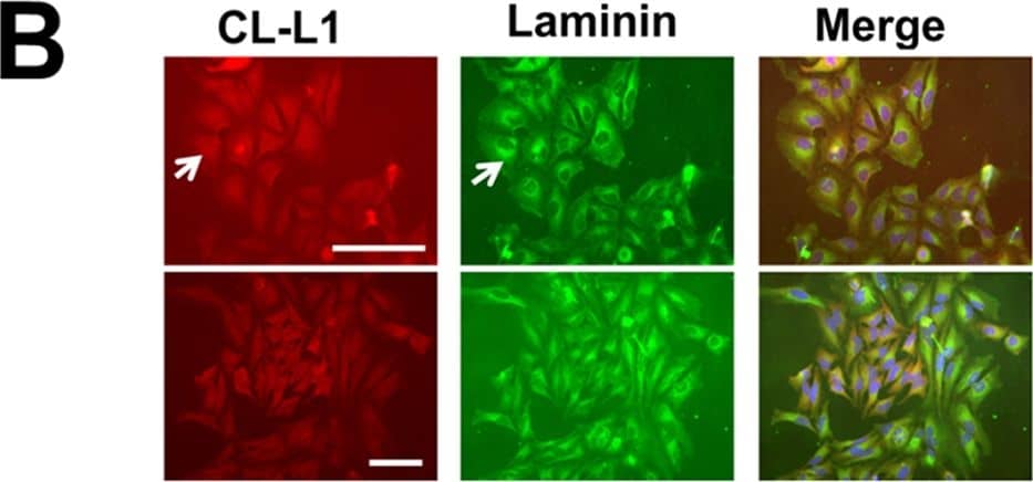 Immunocytochemistry/ Immunofluorescence: COLEC10 Antibody (4C1) [H00010584-M01] - Cellular & embryonic localisation of CL-L1.A. Immunostaining of ATDC5 cells with the golgi marker 58K & CL-L1. CL-L1 shows localisation with golgi apparatus (white arrow). B. Laminin & CL-L1 coimmunolocalisation. Laminin shows partial cellular immunolocalisiton with CL-L1 around the golgi area (arrows). Scale bar 50 μm C. Laminin & CL-K1 coimmunolocalisation. CL-K1 staining shows a very strong golgi localisation with partial cytoplasmatic laminin colocalisation. D. CL-L1 immunohistochemistry of a 18.5 days postfertilisation mouse embryo. CL-L1 is expressed in the liver (long arrow) & submucosal patal region (short arrows). E. Immunofluorescence showing co-localisation of CL-L1 & Laminin in E13.5 mouse embryos sections. CL-L1 is expressed in the basal membrane of the ephithelium in the palate shelf of the maxilla (arrows). In contrast Laminin expression is present all around the ephitelium membrane. A faint but clear CL-L1 expression is also observed in the cytoplasm of the epithelium & in the mesenchyme of the palate. PSM; rostral extremity of right palatal shelf of maxilla. Scale bar 100 μm. Image collected & cropped by CiteAb from the following publication (//pubmed.ncbi.nlm.nih.gov/28301481), licensed under a CC-BY license. Not internally tested by Novus Biologicals.