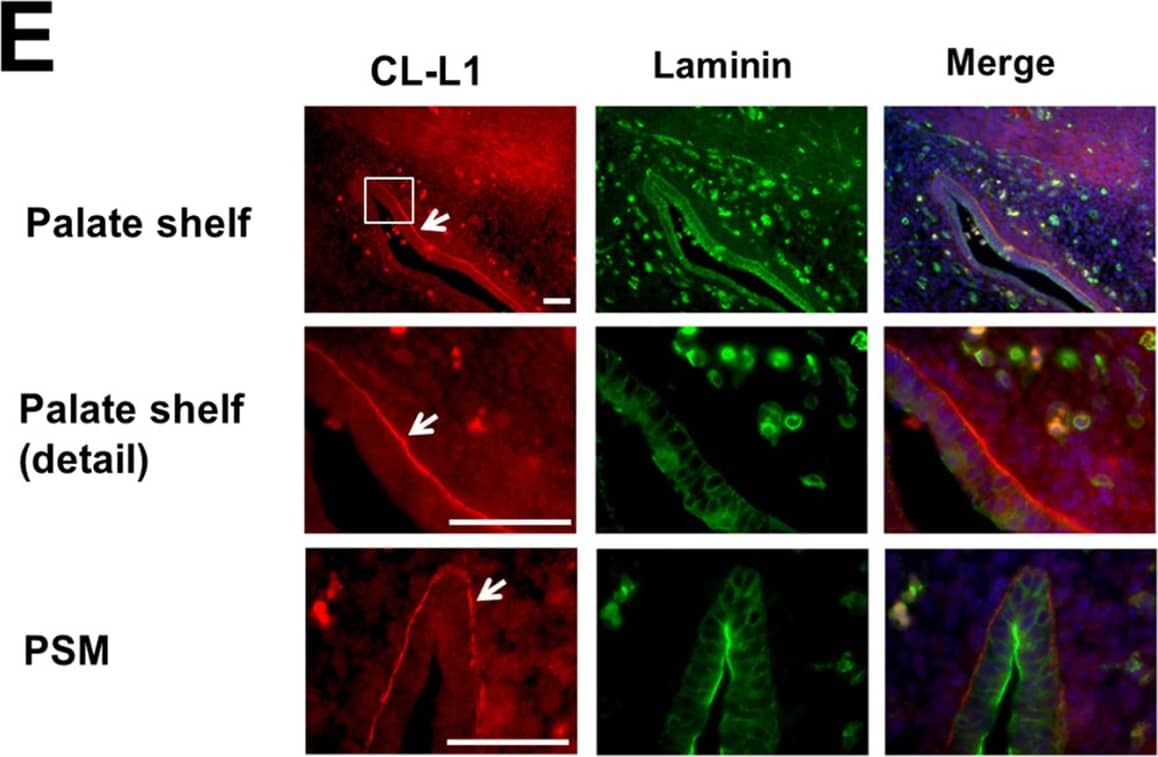 Immunocytochemistry/ Immunofluorescence: COLEC10 Antibody (4C1) [H00010584-M01] - Cellular & embryonic localisation of CL-L1.A. Immunostaining of ATDC5 cells with the golgi marker 58K & CL-L1. CL-L1 shows localisation with golgi apparatus (white arrow). B. Laminin & CL-L1 coimmunolocalisation. Laminin shows partial cellular immunolocalisiton with CL-L1 around the golgi area (arrows). Scale bar 50 μm C. Laminin & CL-K1 coimmunolocalisation. CL-K1 staining shows a very strong golgi localisation with partial cytoplasmatic laminin colocalisation. D. CL-L1 immunohistochemistry of a 18.5 days postfertilisation mouse embryo. CL-L1 is expressed in the liver (long arrow) & submucosal patal region (short arrows). E. Immunofluorescence showing co-localisation of CL-L1 & Laminin in E13.5 mouse embryos sections. CL-L1 is expressed in the basal membrane of the ephithelium in the palate shelf of the maxilla (arrows). In contrast Laminin expression is present all around the ephitelium membrane. A faint but clear CL-L1 expression is also observed in the cytoplasm of the epithelium & in the mesenchyme of the palate. PSM; rostral extremity of right palatal shelf of maxilla. Scale bar 100 μm. Image collected & cropped by CiteAb from the following publication (//pubmed.ncbi.nlm.nih.gov/28301481), licensed under a CC-BY license. Not internally tested by Novus Biologicals.