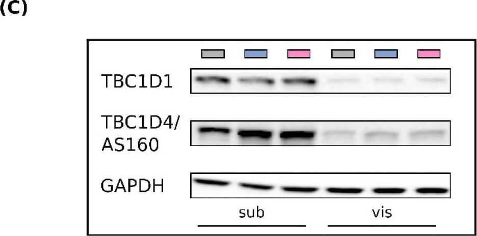 Western Blot TBC1D1 Antibody - Azide and BSA Free