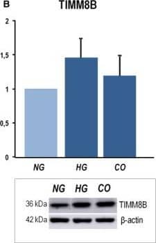 Western blot analysis of MRPL18 (A), TIMM8B (B), and EIF1A (C) from in vitro experiments using a normal colon mucosa epithelial cell line exposed to high (HG) or NG condition. Relative densitometric quantification and representative immunoblots are shown. CO: (osmotic) control. Error bars indicate SEM. Mann–Whitney statistical U‐test used with three biologically independent replicates included (*P‐value < 0.05).