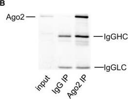 Immunoprecipitation: Ago2/eIF2C2 Antibody (2E12-1C9) [H00027161-M01] - Snail1 is a target of miR‐30c. (A) Sequence alignment between miR‐30c & the 3′‐UTR of Snail1 among several species. (B) Ago2 protein levels in co‐immunoprecipitated products detected by Western blot. IgGHC, IgG heavy chain; IgGLC, IgG light chain. (C) Relative expression of Snail1 in the whole RNA (left) & RNA of the nonspecific IgG or anti‐Ago2 co‐IP (right) from the HG‐treated HK2 cell lysates. #P < 0.05 vs. miR‐con + input, *P < 0.05 vs. miR‐con + IgG IP. (D) Schematic diagram of the luciferase reporter plasmids of pMIR‐Snail1 3′‐UTR & pMIR‐Snail1 3′‐UTR mut, & the potential target site of miR‐30c on the 3′‐UTR of Snail1. (E) Regulation of miR‐30c on 3′‐UTR of Snail1 in HEK293 cells by luciferase reporter assay. *P < 0.05 vs. Snail1 3′‐UTR + miR‐con. (F) Snail1 protein levels of HK2 cells with different treatments detected by Western blot. *P < 0.05 vs. NG, #P < 0.05 vs. HG + miR‐con, &P < 0.05 vs. HG + inhibitor‐con. (G) Snail1 protein levels of renal cortex detected by Western blot. *P < 0.05 vs. C57BL/Ks. #P < 0.05 vs. db/db control. (H) Stability curves of Snail1 mRNA in HG‐treated HK2 cells after transfection of miR‐30c mimics (left) or inhibitor (right). (I) The relative abundance of individual mRNA in each fraction was presented as the percentage of the total fraction following miR‐con (left) or miR‐30c (right) transfection. (J) The association of the Snail1 mRNA with putative polysome fractions (fraction 12 & fraction 13) after miR‐30c mimics transfection. Data are representative of three experiments. Data are expressed as mean ± SEM, n ≥ 3. Image collected & cropped by CiteAb from the following publication (//pubmed.ncbi.nlm.nih.gov/28127848), licensed under a CC-BY license. Not internally tested by Novus Biologicals.