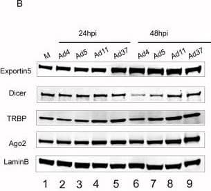 Western Blot: Ago2/eIF2C2 Antibody (2E12-1C9) [H00027161-M01] - The impact of different HAd infections on RNAi/miRNA-pathway proteins.(A) Efficiency of different HAd infections. HeLa cells were infected with the indicated viruses, followed by a 35S-methionine pulse labeling after 24 & 48 hpi. Total protein lysates were separated on an SDS-PAGE & protein synthesis visualized by autoradiography. Accumulation of late viral hexon protein is indicated by an arrow. (B) HAd infections do not affect RNAi/miRNA-pathway protein levels. Western blot analysis on the same protein samples as in panel A was used to monitor the levels of RNAi/miRNA-pathway proteins Exportin 5, Dicer, TRBP & Ago2. Detection of the Lamin B protein served as a loading control. Letter “M” denotes mock, non-infected samples. The different panels were repeated at least two times. Image collected & cropped by CiteAb from the following publication (//pubmed.ncbi.nlm.nih.gov/25144466), licensed under a CC-BY license. Not internally tested by Novus Biologicals.