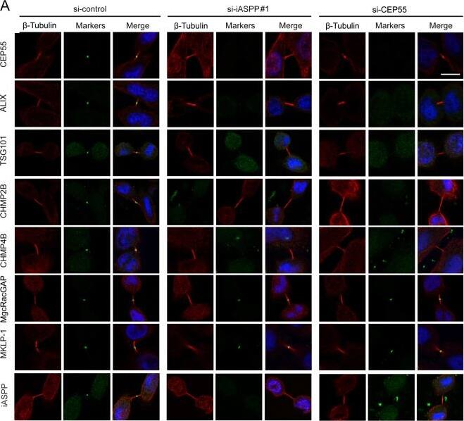 iASPP-dependent localization of midbody markers.a Localization of midbody markers in control, iASPP-depleted, or CEP55-depleted HeLa cells. HeLa cells were transfected with indicated siRNAs. After 48 h, cells were immunostained for midbody markers (green),  beta -tubulin (red), and DNA (blue). b Quantification of proportions of cells from a displaying defects in localization of markers at the midbody