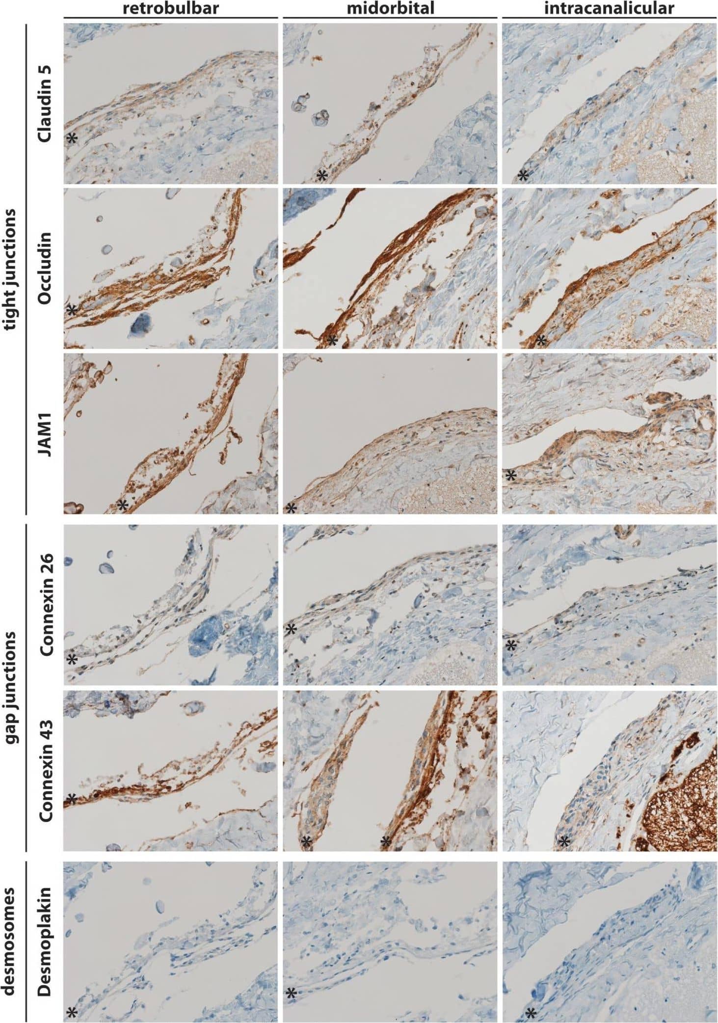 Immunohistochemistry: JAM-A Antibody (2E3-1C8) [H00050848-M01] - Coronal sections of human meninges including the retrobulbar, midorbital, & intracanalicular part of the optic nerve stained for cell–cell interaction markers of tight junctions (JAM1, Occludin, & Claudin 5), gap junctions (Connexin 26 & 43), & desmosomes (Desmoplakin). A representative staining of one patient is shown. * indicates arachnoid layer. Image collected & cropped by CiteAb from the following publication (//pubmed.ncbi.nlm.nih.gov/28706505), licensed under a CC-BY license. Not internally tested by Novus Biologicals.