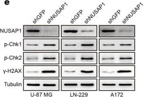 Western Blot: NUSAP1 Antibody [H00051203-B01P] - Depletion of NUSAP1 induces DNA damage in GBM cells. a Mini ontology obtained in French’s database using gene sets related to NUSAP1, which were identified by a significant difference of P < 0.001. b Tailed DNA in single cells depleted of NUSAP1. c IF staining of  gamma -H2AX in NUSAP1-knockdown GBM cells. d Quantification of  gamma -H2AX foci in the indicated GBM cells. e Western blot analyses of DDR proteins in GBM with NUSAP1 knockdown. f The level of the indicated proteins in GBM cells with NUSAP1 knockdown for 0 h, 24 h, 48 h, 72 h, & 96 h. All data are used as the mean ± SD, & significant differences were determined by Student’s t test. *P < 0.05, **P < 0.01, ***P < 0.001. P < 0.05 was considered statistically significant Image collected & cropped by CiteAb from the following publication (//pubmed.ncbi.nlm.nih.gov/32317623), licensed under a CC-BY license. Not internally tested by Novus Biologicals.