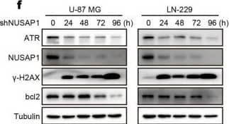 Western Blot: NUSAP1 Antibody [H00051203-B01P] - Depletion of NUSAP1 induces DNA damage in GBM cells. a Mini ontology obtained in French’s database using gene sets related to NUSAP1, which were identified by a significant difference of P < 0.001. b Tailed DNA in single cells depleted of NUSAP1. c IF staining of  gamma -H2AX in NUSAP1-knockdown GBM cells. d Quantification of  gamma -H2AX foci in the indicated GBM cells. e Western blot analyses of DDR proteins in GBM with NUSAP1 knockdown. f The level of the indicated proteins in GBM cells with NUSAP1 knockdown for 0 h, 24 h, 48 h, 72 h, & 96 h. All data are used as the mean ± SD, & significant differences were determined by Student’s t test. *P < 0.05, **P < 0.01, ***P < 0.001. P < 0.05 was considered statistically significant Image collected & cropped by CiteAb from the following publication (//pubmed.ncbi.nlm.nih.gov/32317623), licensed under a CC-BY license. Not internally tested by Novus Biologicals.