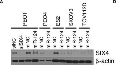 Western Blot: SIX4 Antibody (7E2) [H00051804-M09] - Selective addiction of EOC to the SIX4 homeobox transcription factorImmunoblots indicate miR‐124‐induced SIX4 depletion. siSIX4 is shown as an antibody control.Consequence of SIX4 depletion on EOC cell viability (as in Fig 2A, N, normal cell lines: HOSE, HBEC30).In vivo knockdown of SIX4 using neutral liposome‐incorporated siRNA reduced tumor burden & ascites volume in an orthotopic xenograft mouse model. Box‐and‐whisker plot of tumor weight (left panel) or ascites volume (right panel) from n = 7 or 8 mice per condition as indicated. *P‐value from Student's t‐test.Consequence of SIX4 depletion in PEO1 cells on E‐cadherin plasma membrane accumulation 48 h after transfection. Cells were counterstained with phalloidin & DAPI.Immunoblots indicate consequence of SIX4 depletion on LKB1 accumulation & AMPK pathway activation.Source data are available online for this figure. Image collected & cropped by CiteAb from the following publication (//pubmed.ncbi.nlm.nih.gov/26655797), licensed under a CC-BY license. Not internally tested by Novus Biologicals.