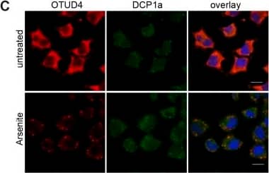 Immunocytochemistry/ Immunofluorescence: Dcp1a Antibody (3G4) [H00055802-M06] - OTUD4 is recruited to stress granules. (A) Immunofluorescence of OTUD4 (shown in red) in SH-SY5Y cells that were either untreated, arsenite-treated (30 min, 0.5 mM) or heat-shocked (42°C, 1 h). Cells were co-stained for the stress granule marker protein TIA1 (green) & DAPI as a nuclear marker (blue). OTUD4 is redistributed to granular structures upon arsenite & heat-shock treatment. Granules also contain TIA1 & are considered as stress granules. Scale bar: 20 µm. The experiment was repeated two times. (B) Exogenously expressed FLAG–OTUD4 is recruited to stress granules in HeLa cells. Transfected cells were arsenite-treated (0.5 mM) for 40 min or left untreated & co-stained with anti-FLAG (red) & anti-G3BP1 antibodies (green). Nuclei are shown in blue (DAPI). Scale bar: 20 µm. The experiment was done at least three times. (C) OTUD4 granules do not colocalize with P-bodies. Shown is immunofluorescence of HeLa cells (untreated or 0.5 mM arsenite for 30 min) stained with anti-OTUD4 (red) & anti-DCP1a (green) antibodies. Scale bar: 20 µm. The experiment was performed two times. (D) OTUD4 granules contain mRNA. HeLa cells were treated with arsenite (0.5 mM) for 1 h. FISH was carried out with Cy3-labeled oligo(dT) (red), & cells were co-stained with anti-OTUD4 (shown in green). Scale bar: 20 µm. A representative image from four independent experiments is shown. (E) Scheme illustrating OTUD4 fragments used in F, numbers indicate amino acid borders of expression constructs. IDR, intrinsically disordered region. (F) HeLa cells were transfected with EGFP-tagged OTUD4 expression constructs as shown in E) & treated with arsenite (0.5 mM for 30 min) or left untreated to monitor intrinsic ability to form granules. Image collected & cropped by CiteAb from the following publication (//pubmed.ncbi.nlm.nih.gov/31138677), licensed under a CC-BY license. Not internally tested by Novus Biologicals.