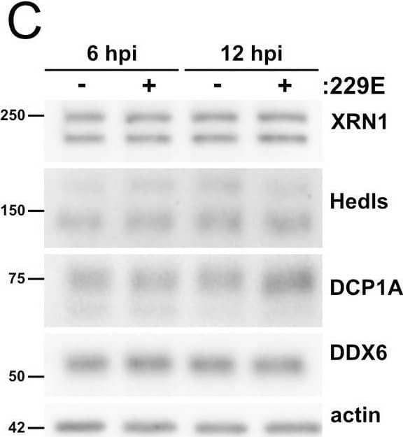 Coronavirus infection does not alter steady state levels of most processing body proteins.A. HUVECs were transduced with human ACE2 (HUVECACE2), selected, and infected with SARS-CoV-2 TO-1 isolate (MOI = 3). Cells were lysed at 6 and 12 hours post infection and immunoblotting was performed using XRN1, Hedls, DCP1A, DDX6, SARS-CoV-2 N, and  beta -actin specific antibodies. One representative experiment of two is shown. B-C. HUVECs were infected with OC43 (B, TCID50 = 2 x 104) or 229E (C, TCID50 = 2.4 x 103). Cells were lysed at 12 and 24 hours post infection (B, OC43) or 6 and 12 hours post infection (C, 229E). Immunoblotting was performed using XRN1, Hedls, DCP1A, DDX6, OC43 N protein (B only), and  beta -actin specific antibodies. One representative experiment of three is shown. Image collected and cropped by CiteAb from the following open publication (//pubmed.ncbi.nlm.nih.gov/35998203), licensed under a CC-BY license. Not internally tested by Novus Biologicals.