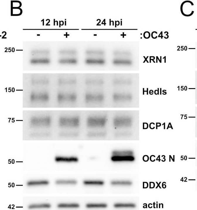 Coronavirus infection does not alter steady state levels of most processing body proteins.A. HUVECs were transduced with human ACE2 (HUVECACE2), selected, and infected with SARS-CoV-2 TO-1 isolate (MOI = 3). Cells were lysed at 6 and 12 hours post infection and immunoblotting was performed using XRN1, Hedls, DCP1A, DDX6, SARS-CoV-2 N, and  beta -actin specific antibodies. One representative experiment of two is shown. B-C. HUVECs were infected with OC43 (B, TCID50 = 2 x 104) or 229E (C, TCID50 = 2.4 x 103). Cells were lysed at 12 and 24 hours post infection (B, OC43) or 6 and 12 hours post infection (C, 229E). Immunoblotting was performed using XRN1, Hedls, DCP1A, DDX6, OC43 N protein (B only), and  beta -actin specific antibodies. One representative experiment of three is shown. Image collected and cropped by CiteAb from the following open publication (//pubmed.ncbi.nlm.nih.gov/35998203), licensed under a CC-BY license. Not internally tested by Novus Biologicals.