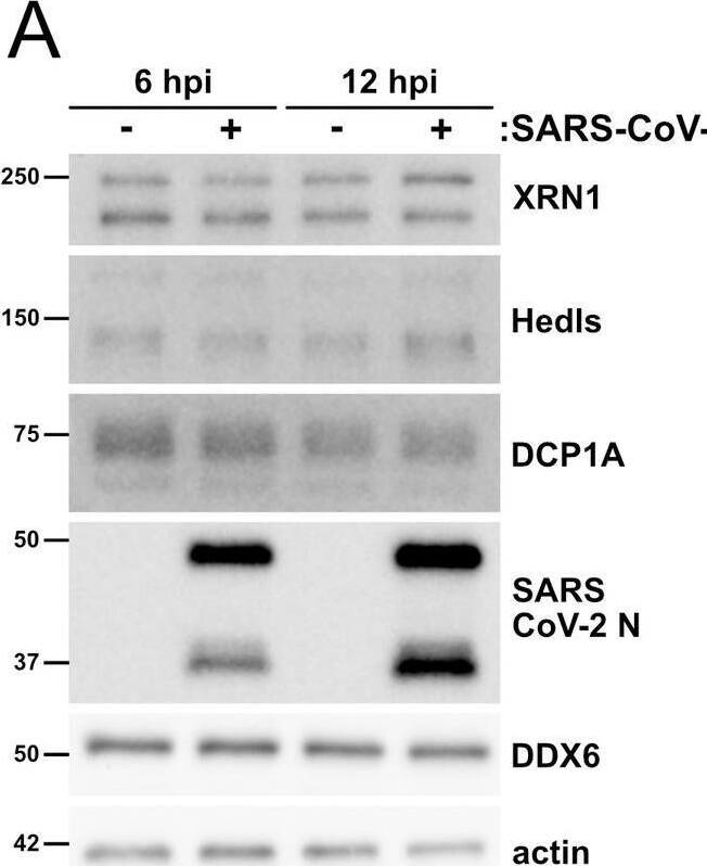 Coronavirus infection does not alter steady state levels of most processing body proteins.A. HUVECs were transduced with human ACE2 (HUVECACE2), selected, and infected with SARS-CoV-2 TO-1 isolate (MOI = 3). Cells were lysed at 6 and 12 hours post infection and immunoblotting was performed using XRN1, Hedls, DCP1A, DDX6, SARS-CoV-2 N, and  beta -actin specific antibodies. One representative experiment of two is shown. B-C. HUVECs were infected with OC43 (B, TCID50 = 2 x 104) or 229E (C, TCID50 = 2.4 x 103). Cells were lysed at 12 and 24 hours post infection (B, OC43) or 6 and 12 hours post infection (C, 229E). Immunoblotting was performed using XRN1, Hedls, DCP1A, DDX6, OC43 N protein (B only), and  beta -actin specific antibodies. One representative experiment of three is shown. Image collected and cropped by CiteAb from the following open publication (//pubmed.ncbi.nlm.nih.gov/35998203), licensed under a CC-BY license. Not internally tested by Novus Biologicals.
