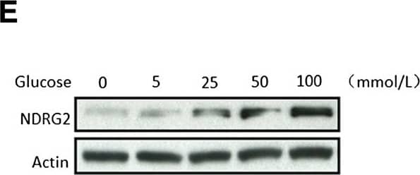 Western Blot: NDRG2 Antibody (6A5) [H00057447-M03] - NDRG2 inhibits cell proliferation & reduces intracellular glucose levels of breast cancer cells. (E) & (F) SK-BR-3 cells cultured to glucose medium at concentrations of 0, 5, 25, 50 & 100 mM for 24 hrs, & then the protein or mRNA was extracted for analysis by immunoblotting (E) or real-time PCR (F).  beta -actin used as a loading control. The data presented means ± SD; error bars represented SD from 3 replicative wells. *P < 0.05 & **P < 0.01 versus control group. Image collected & cropped by CiteAb from the following publication (//breast-cancer-research.biomedcentral.com/articles/10.1186/bcr3628), licensed under a CC-BY license. Not internally tested by Novus Biologicals.