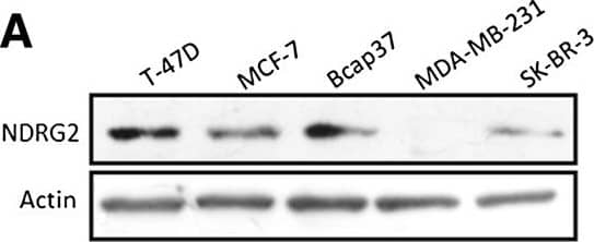 Western Blot: NDRG2 Antibody (6A5) [H00057447-M03] - NDRG2 inhibits cell proliferation & reduces intracellular glucose levels of breast cancer cells. (A) T-47D, MCF-7, Bcap37, MDA-MB-231 & SK-BR-3 cells collected for the extraction of proteins & analysed for N-myc downstream-regulated gene 2 (NDRG2) expression by immunoblotting. Image collected & cropped by CiteAb from the following publication (//breast-cancer-research.biomedcentral.com/articles/10.1186/bcr3628), licensed under a CC-BY license. Not internally tested by Novus Biologicals.