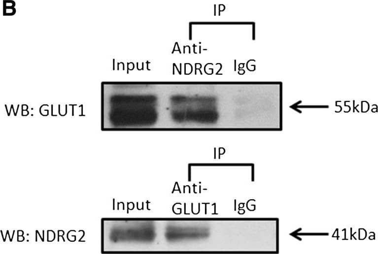 Western Blot: NDRG2 Antibody (6A5) [H00057447-M03] - NDRG2 interacts with GLUT1. (A) SK-BR-3 cells were fixed & incubated with primary antibodies against N-myc downstream-regulated gene 2 (NDRG2) or glucose transporter 1 (GLUT1) & with fluorescein isothiocyanate or a cyanine 3 secondary antibody. Green fluorescence indicates NDRG2 expression, red fluorescence indicates GLUT1 expression & blue fluorescence indicates nuclear staining. The results of the merged images reveal that NDRG2 & GLUT1 were colocalised in the cytoplasm. (B) Immunoprecipitation (IP) assays were performed with whole-cell lysates of SK-BR-3 cells pretreated with protein A–conjugated sepharose beads. Whole-cell lysates were probed for input. The antibodies for immunoprecipitation & Western blot (WB) analyses were carried out as indicated. The locations of various proteins are indicated by arrowheads. IgG, Immunoglobulin G. Image collected & cropped by CiteAb from the following publication (//breast-cancer-research.biomedcentral.com/articles/10.1186/bcr3628), licensed under a CC-BY license. Not internally tested by Novus Biologicals.