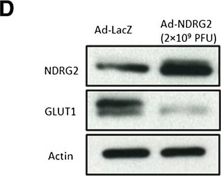 Western Blot: NDRG2 Antibody (6A5) [H00057447-M03] - NDRG2 decreases the glucose uptake & GLUT1 protein levels in SK-BR-3-based subcutaneously xenograft tumours. The experiments illustrated are described in the Methods section. (A) Tumour growth was assessed every 3 days until day 21 treatment by measuring two perpendicular diameters & calculating the volume in cubic centimetres. Ad-LacZ, adenovirus expressing LacZ; Ad-NDRG2, adenovirus expressing NDRG2; PFU, Plaque-forming units. The data presented are means ± SD; error bars represent SD from 6 mice. *P < 0.05 & **P < 0.01 versus phosphate-buffered saline (PBS) or Ad-LacZ. (B) Tumour cells were dissociated from xenograft tumours & suspended in PBS after the number of cells was counted. Next, the glucose uptake of cells in each group was detected. The data presented are means ± SD of three independent experiments; error bars represent SD from 6 mice. *P < 0.05 & **P < 0.01 versus PBS or Ad-LacZ. (C) Intratumoural protein expression was assessed by N-myc downstream-regulated gene 2 (NDRG2) & glucose transporter 1 (GLUT1) IHC staining. Representative images are shown. Original magnification: 400 x; Scale bars = 50 μm. (D) Proteins of the xenograft tumours from each group were extracted & analysed by immunoblotting to quantify NDRG2 & GLUT1 protein changes. Image collected & cropped by CiteAb from the following publication (//breast-cancer-research.biomedcentral.com/articles/10.1186/bcr3628), licensed under a CC-BY license. Not internally tested by Novus Biologicals.