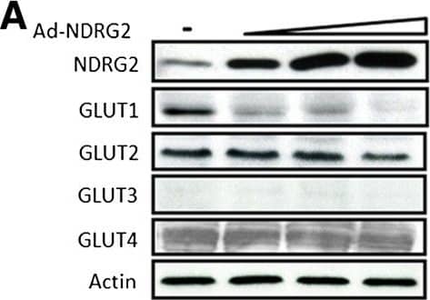 Western Blot: NDRG2 Antibody (6A5) [H00057447-M03] - NDRG2 downregulates GLUT1 by promoting its ubiquitination. (A), (C) & (E) SK-BR-3 cells were infected with an adenovirus carrying N-myc downstream-regulated gene 2 (Ad-NDRG2) at 1, 5 & 10 multiplicity of infection (MOI) or Ad-LacZ for 48 hours. (B), (D) & (F) T-47D cells were transfected with NDRG2 small interfering RNA (siRNA) 10, 25 & 100 pmol or control siRNA for 48 hours. Next, cell proteins or mRNA were extracted & analysed by immunoblotting (A) & (B) or by real-time PCR (C) to (F).  beta -actin was used as a loading control. (C) – (F) The data presented are the means ± SD of three independent experiments; error bars represent SD from 3 replicative wells. *P < 0.05 & **P < 0.01 versus control group. (G) SK-BR-3 cells were infected with 10 MOI Ad-NDRG2 or Ad-LacZ for 48 hours & then treated with 2 μM, 6 μM or 8 μM MG-132 for 4 hours. Next, the protein was extracted & analysed by immunoblotting. (H) Cell fractions were prepared from the SK-BR-3 cells infected with 10 MOI Ad-NDRG2 or Ad-LacZ for 48 hours, & the membrane & cytosolic fractions of endogenous glucose transporter 1 (GLUT1) protein were detected. Tubulin &  beta -actin served as loading controls. (I) SK-BR-3 cells were transfected with hemagglutinin (HA)-ubiquitin plasmid for 6 hours & infected with Ad-NDRG2 or Ad-LacZ for another 48 hours. Subsequently, the cell lysates were collected & analysed by immunoprecipitation (IP) & immunoblotting with GLUT1 & HA antibodies. WB, Western blot. Image collected & cropped by CiteAb from the following publication (//breast-cancer-research.biomedcentral.com/articles/10.1186/bcr3628), licensed under a CC-BY license. Not internally tested by Novus Biologicals.