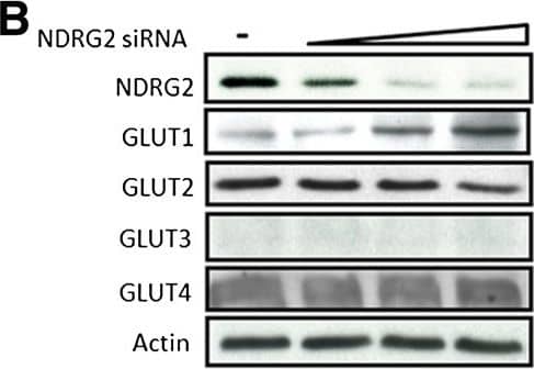 Western Blot: NDRG2 Antibody (6A5) [H00057447-M03] - NDRG2 downregulates GLUT1 by promoting its ubiquitination. (A), (C) & (E) SK-BR-3 cells were infected with an adenovirus carrying N-myc downstream-regulated gene 2 (Ad-NDRG2) at 1, 5 & 10 multiplicity of infection (MOI) or Ad-LacZ for 48 hours. (B), (D) & (F) T-47D cells were transfected with NDRG2 small interfering RNA (siRNA) 10, 25 & 100 pmol or control siRNA for 48 hours. Next, cell proteins or mRNA were extracted & analysed by immunoblotting (A) & (B) or by real-time PCR (C) to (F).  beta -actin was used as a loading control. (C) – (F) The data presented are the means ± SD of three independent experiments; error bars represent SD from 3 replicative wells. *P < 0.05 & **P < 0.01 versus control group. (G) SK-BR-3 cells were infected with 10 MOI Ad-NDRG2 or Ad-LacZ for 48 hours & then treated with 2 μM, 6 μM or 8 μM MG-132 for 4 hours. Next, the protein was extracted & analysed by immunoblotting. (H) Cell fractions were prepared from the SK-BR-3 cells infected with 10 MOI Ad-NDRG2 or Ad-LacZ for 48 hours, & the membrane & cytosolic fractions of endogenous glucose transporter 1 (GLUT1) protein were detected. Tubulin &  beta -actin served as loading controls. (I) SK-BR-3 cells were transfected with hemagglutinin (HA)-ubiquitin plasmid for 6 hours & infected with Ad-NDRG2 or Ad-LacZ for another 48 hours. Subsequently, the cell lysates were collected & analysed by immunoprecipitation (IP) & immunoblotting with GLUT1 & HA antibodies. WB, Western blot. Image collected & cropped by CiteAb from the following publication (//breast-cancer-research.biomedcentral.com/articles/10.1186/bcr3628), licensed under a CC-BY license. Not internally tested by Novus Biologicals.