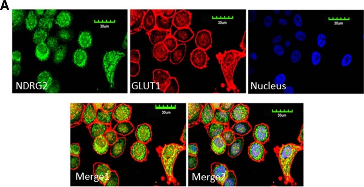 Immunocytochemistry/ Immunofluorescence: NDRG2 Antibody (6A5) [H00057447-M03] - NDRG2 interacts with GLUT1. (A) SK-BR-3 cells were fixed & incubated with primary antibodies against N-myc downstream-regulated gene 2 (NDRG2) or glucose transporter 1 (GLUT1) & with fluorescein isothiocyanate or a cyanine 3 secondary antibody. Green fluorescence indicates NDRG2 expression, red fluorescence indicates GLUT1 expression & blue fluorescence indicates nuclear staining. The results of the merged images reveal that NDRG2 & GLUT1 were colocalised in the cytoplasm. (B) Immunoprecipitation (IP) assays were performed with whole-cell lysates of SK-BR-3 cells pretreated with protein A–conjugated sepharose beads. Whole-cell lysates were probed for input. The antibodies for immunoprecipitation & Western blot (WB) analyses were carried out as indicated. The locations of various proteins are indicated by arrowheads. IgG, Immunoglobulin G. Image collected & cropped by CiteAb from the following publication (//breast-cancer-research.biomedcentral.com/articles/10.1186/bcr3628), licensed under a CC-BY license. Not internally tested by Novus Biologicals.