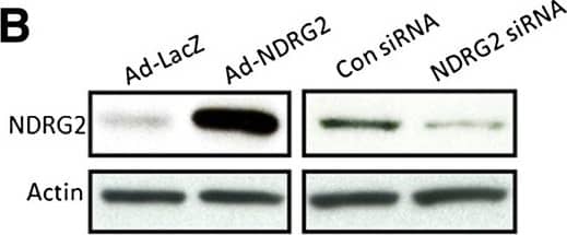 Western Blot: NDRG2 Antibody (6A5) [H00057447-M03] - NDRG2 inhibits cell proliferation & reduces intracellular glucose levels of breast cancer cells. (B) SK-BR-3 cells with low NDRG2 expression infected by an adenovirus carrying NDRG2 (Ad-NDRG2) or negative control LacZ (Ad-LacZ), & T-47D cells with high NDRG2 transfected with small interfering RNA targeting NDRG2 (NDRG2 siRNA) or negative control siRNA (Con siRNA). Thereafter proteins extracted from these cells & analysed by immunoblotting.  beta -actin used as a loading control. Before being cultured in 25 mM high-glucose (H.G.) or 5.5 mM low-glucose (L.G.) medium, SK-BR-3 cells infected by Ad-NDRG2 (C) & T-47D cells transfected by NDRG2 siRNA (D). Cell proliferation was detected by 3-(4,5-dimethylthiazol-2-yl)-2,5-diphenyltetrazolium bromide assay for 1 to 5 days.Image collected & cropped by CiteAb from the following publication (//breast-cancer-research.biomedcentral.com/articles/10.1186/bcr3628), licensed under a CC-BY license. Not internally tested by Novus Biologicals.