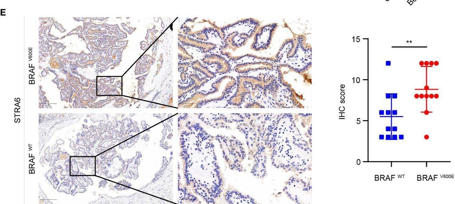 Immunohistochemistry STRA6 Antibody - Azide and BSA Free