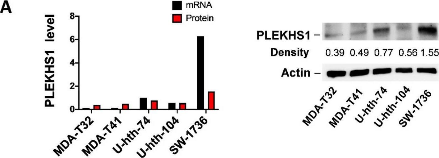 PLEKHS1 is over-expressed in thyroid cancer (TC)-derived cell lines and primary tumors. (A) PLEKHS1 expression in TC cell lines. Left and right: PLEKHS1 mRNA and protein expression levels as determined using qPCR and immunoblotting, respectively. The quantification results (band intensity) in the right panel are shown in the left panel. (B) Differential expression of PLEKHS1 mRNA between non-cancerous adjacent thyroid tissues and primary PTC tumors. The TCGA cohort of PTC tumors and adjacent tissues are analyzed and mRNA levels were expressed as FPKM (Fragments Per Kilobase Million). (C) Higher levels of PLEKHS1 expression in ATC tumors than PTCs. (D) PLEKHS1 mRNA and protein expression levels in 20 PTC tumors as determined using qPCR and immunoblotting, respectively. The quantification results (band intensity) in the bottom panel are shown in the top panel. (E) Positive correlation between PLEKHS1 mRNA and protein expression, as revealed by the analysis of combined results from both TC cell lines (A) and primary PTC tumors (D). Image collected and cropped by CiteAb from the following open publication (//pubmed.ncbi.nlm.nih.gov/32752127), licensed under a CC-BY license. Not internally tested by Novus Biologicals.