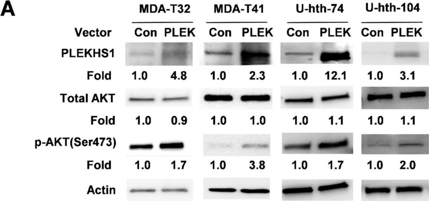 PLEKHS1 over-expression promotes AKT phosphorylation, proliferation and migration/invasion in PTC- and ATC-derived cells. (A) Increased AKT phosphorylation in PLEKHS1-transfected cells. MDA-T32, MDA-T41, U-hth-74, and U-hth-104 cells were transfected with control (Con) empty and PLEKHS1 (PLEK) expression vectors, respectively, and harvested 48 h post-transfection for total AKT and phosphorylated AKT levels using immunoblotting. One representative experiment out of three independent experiments is shown. The fold change for PLEKHS1, total and phosphorylated AKT is indicated (based on their signal intensity normalized to  beta -actin). (B) Increased cell proliferation of cells overexpressing PLEKHS1. MDA-T32, MDA-T41 and U-hth-104 cells above were incubated for 48 h and then counted. The number of control cells was set as 100%. Shown are the results from three independent experiments. (C) Enhanced migration and invasion of PLEKHS1-overexpressed cells. MDA-T32, MDA-T41 and U-hth-104 cells above were analyzed for their migration and invasion capacities using a transwell assay system. Left: representative images of migration or invasion. Right: the quantification of migrating or invading cells based on three independent experiments. Image collected and cropped by CiteAb from the following open publication (//pubmed.ncbi.nlm.nih.gov/32752127), licensed under a CC-BY license. Not internally tested by Novus Biologicals.