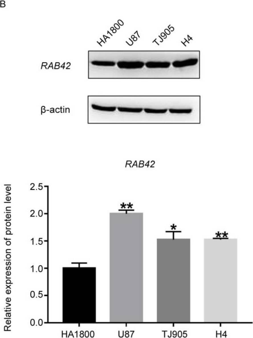 The RAB42 expression levels in local GBM cells and specmens. (A,B) RAB42 mRNA expression and protein expression were both upregulated in GBM cell lines, respectively (vs. HA1800; * p <0.05, ** p < 0.01, *** p < 0.001). Image collected and cropped by CiteAb from the following open publication (https://pubmed.ncbi.nlm.nih.gov/35741652), licensed under a CC-BY license. Not internally tested by Novus Biologicals.