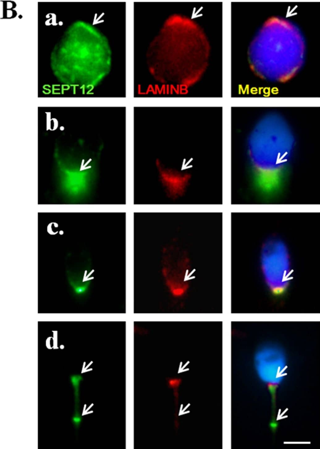 Immunocytochemistry/ Immunofluorescence: Septin-12 Antibody [H00124404-B01P] - SEPT12 interacts & colocalizes with LAMINB1 male germ cells.(A) Co-IP of FLAG-SPAG4 & LAIMINB1 with SEPT12-GFP. The cell lysates of the NT2D1 cells, transfected with pEGFP-SEPT12 & a pFLAG-SPAG4 vector, are subjected to IP with an anti-GFP antibody (right panel, Row 3) or a nonspecific control IgG (right panel, Row 2), followed by IB with an anti-GFP, anti-FLAG, or anti-LAMINB1 antibody. An input protein (5%) was used as a control during the IB of the transfected cell lysates (right panel, Row 1). (B) An IFA revealed multiple localizations of SEPT12 & LAMINB1 signals. A total of 32 male germ cells were were evaluated as (A) Round spermatids (n = 9; labeled with anti-SEPT12 & anti-LAMINB1antibodies as the presented figure,9/9); (B) elongating & (C) elongated spermatids (n = 11;11/11); (D) ejaculated spermatozoa (n = 10;10/10). (A–D) Anti-SEPT12 antibody (left panel; green), anti-LAMINB1 antibody (middle panel; red), & a combination of the left & middle panels (right panel). The arrow indicates SEPT12 or LAMINB1 signals. Scale bar: 5 μm. Image collected & cropped by CiteAb from the following publication (//dx.plos.org/10.1371/journal.pone.0120722), licensed under a CC-BY license. Not internally tested by Novus Biologicals.
