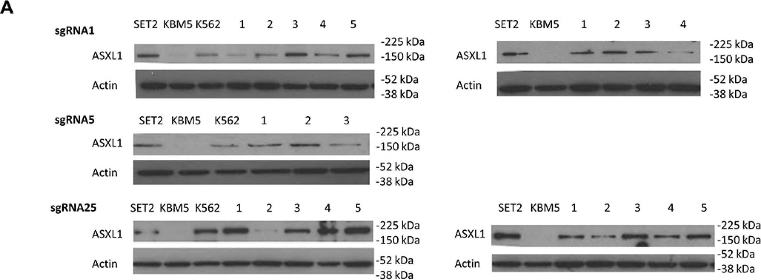 Western Blot: ASXL1 Antibody (6E2) [H00171023-M05] - Functional effects of CRISPR/Cas9-mediated ASXL1 mutation correction(A) Evaluation of ASXL1 protein expression by WB. Left: ASXL1 protein expression in SET2 leukemia cell line (wild-type for ASXL1), uncorrected KBM5 cells, the K562 leukemia cell line (carrying the Y591X heterozygous ASXL1 mutation), & KBM5 clones (labeled 1–5) w/ heterozygous precise correction of ASXL1 mutation. Right: ASXL1 protein expression in SET2 leukemia cell line (wild-type for ASXL1), uncorrected KBM5 cells, & KBM5 clones (labeled 1–5) w/ homozygous precise correction of ASXL1 mutation.  beta -actin used as loading control. (B) Evaluation of expression levels of HOXA genes using quantitative real-time PCR (q-RT-PCR). Expression levels of HOXA5, 6, 7, 9, 10 & 13 measured in three ASXL1 homozygous corrected KBM5 clones compared w/ uncorrected cells. Results shown obtained from six independent experiments for each clone. Values in ASXL1 homozygous corrected cells are relative to uncorrected cells. Bar graphs show mean + standard error of mean (s.e.m.) (* = P < 0.05, ** = P < 0.01, *** = P < 0.001, paired t-test). (C) Evaluation of H3K27me3 levels & expression of PRC2 components by WB in uncorrected KBM5 cells & three KBM5 clones w/ homozygous correction of ASXL1 mutation. H3K27me3 levels & total H3 levels evaluated using purified histone fractions. Expression levels of two PRC2 components (EZH2, SUZ12) determined using whole cell lysates.  beta -actin used as loading control. (D) Immunoprecipitation of BAP1 in SET2 leukemia cell line (wild-type for ASXL1), uncorrected KBM5 cells, & three KBM5 clones w/ homozygous correction of ASXL1 mutation. The BAP1 protein fraction immunoprecipitated using a BAP1 antibody & stained for ASXL1 & BAP1. Image collected & cropped by CiteAb from the following publication (//www.oncotarget.com/lookup/doi/10.18632/oncotarget.6392), licensed under a CC-BY license. Not internally tested by Novus Biologicals.