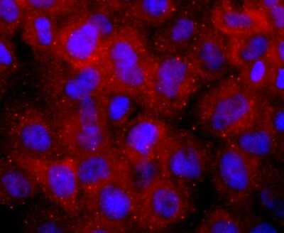 Immunocytochemistry/Immunofluorescence: hCG Alpha (Intact) Antibody (AH21-10) [NBP2-67283] - Staining TSH in JAR cells (red). The nuclear counter stain is DAPI (blue). Cells were fixed in paraformaldehyde, permeabilised with 0.25% Triton X100/PBS.