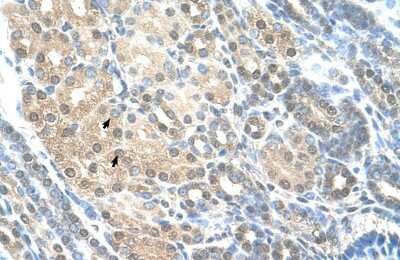 Immunohistochemistry-Paraffin: hHR23A Antibody [NBP1-52942] - Human kidney Tissue, antibody concentration 4-8ug/ml. Cells with positive label: renal corpuscle cells (indicated with arrows) 400X magnification.